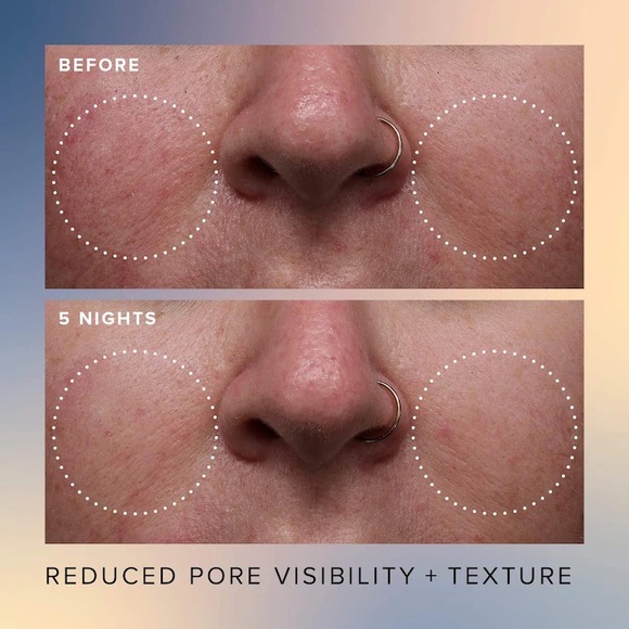 Farmacy Honey Glow 17% Resurfacing Acid Seurum - Picture 5 of 6